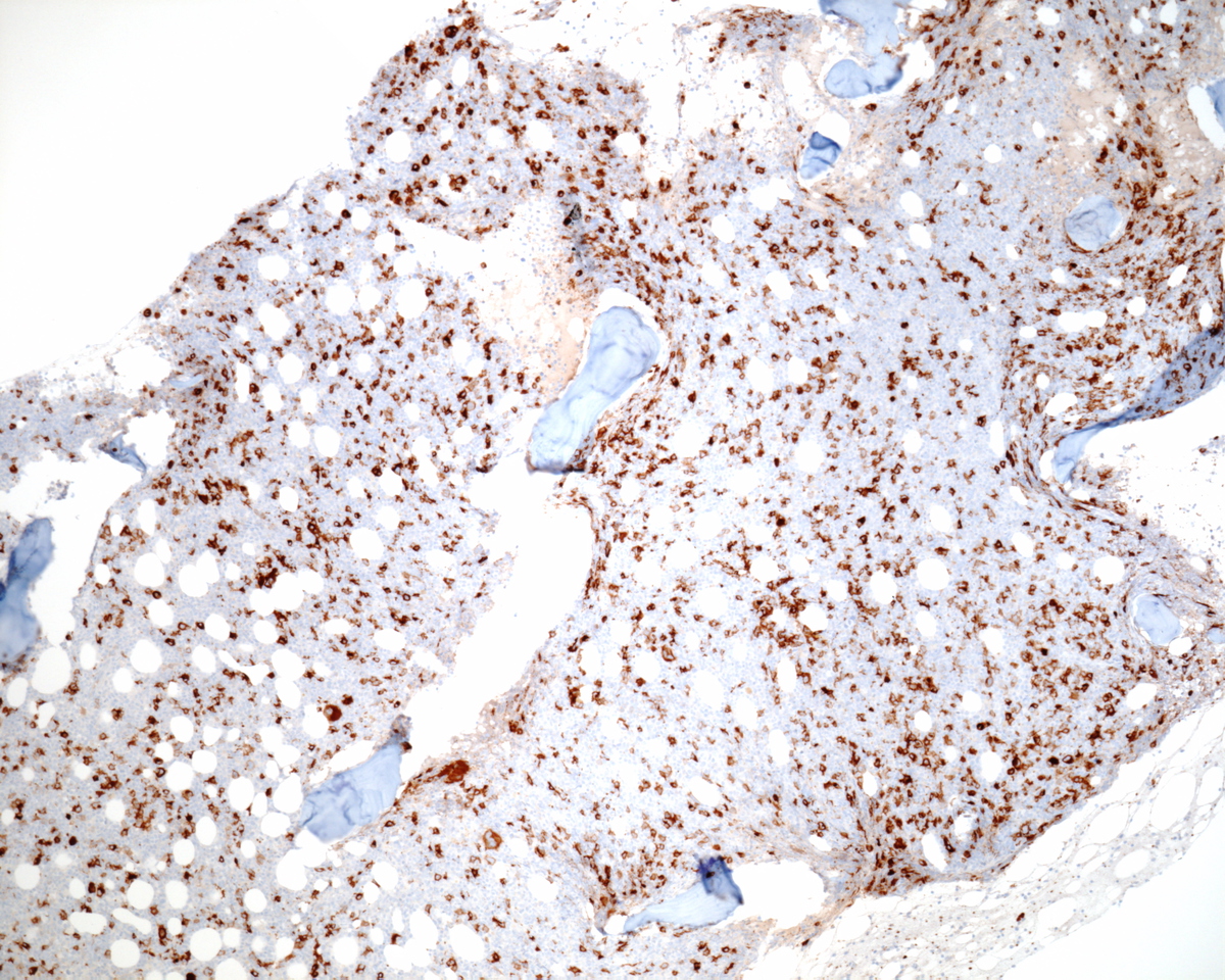  Immunohistochemistry CD61 